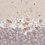 Amyloid Precursor Protein Antibody in Immunohistochemistry (Paraffin) (IHC (P))