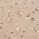 Amyloid Precursor Protein Antibody in Immunohistochemistry (Paraffin) (IHC (P))