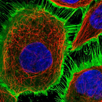 EGFR Polyclonal Antibody