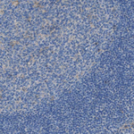 EGFR Antibody in Immunohistochemistry (Paraffin) (IHC (P))