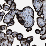 EGFR Antibody in Immunohistochemistry (Paraffin) (IHC (P))
