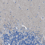 EGFR Antibody in Immunohistochemistry (Paraffin) (IHC (P))