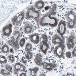 EGFR Antibody in Immunohistochemistry (Paraffin) (IHC (P))
