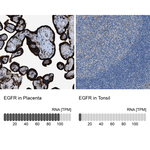 EGFR Antibody in Immunohistochemistry (Paraffin) (IHC (P))
