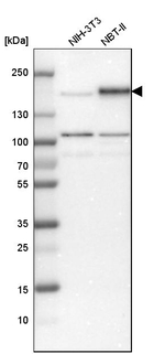 EGFR Antibody in Western Blot (WB)