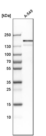 EGFR Antibody in Western Blot (WB)