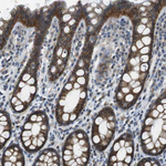 Claudin 7 Antibody in Immunohistochemistry (Paraffin) (IHC (P))