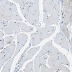 Claudin 7 Antibody in Immunohistochemistry (Paraffin) (IHC (P))