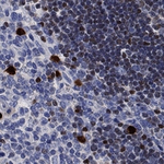 SATB1 Antibody in Immunohistochemistry (Paraffin) (IHC (P))