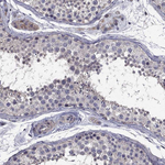 SATB1 Antibody in Immunohistochemistry (Paraffin) (IHC (P))