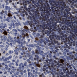 SATB1 Antibody in Immunohistochemistry (Paraffin) (IHC (P))