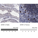 SATB1 Antibody in Immunohistochemistry (Paraffin) (IHC (P))