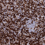 IBA1 Antibody in Immunohistochemistry (Paraffin) (IHC (P))
