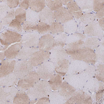 IBA1 Antibody in Immunohistochemistry (Paraffin) (IHC (P))