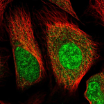Huntingtin Polyclonal Antibody