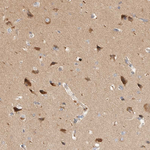 Huntingtin Antibody in Immunohistochemistry (Paraffin) (IHC (P))