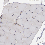 ZO-1 Antibody in Immunohistochemistry (Paraffin) (IHC (P))