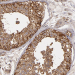 ZO-1 Antibody in Immunohistochemistry (Paraffin) (IHC (P))