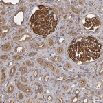 ZO-1 Antibody in Immunohistochemistry (Paraffin) (IHC (P))