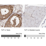 ZO-1 Antibody in Immunohistochemistry (Paraffin) (IHC (P))