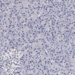 DNMT1 Antibody in Immunohistochemistry (Paraffin) (IHC (P))