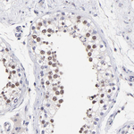 DNMT1 Antibody in Immunohistochemistry (Paraffin) (IHC (P))
