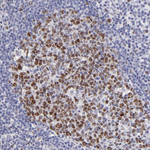 DNMT1 Antibody in Immunohistochemistry (Paraffin) (IHC (P))