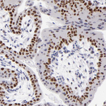DNMT1 Antibody in Immunohistochemistry (Paraffin) (IHC (P))
