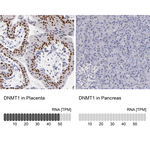 DNMT1 Polyclonal Antibody
