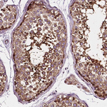 ATG16L1 Antibody in Immunohistochemistry (Paraffin) (IHC (P))