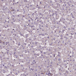ATG16L1 Antibody in Immunohistochemistry (Paraffin) (IHC (P))