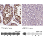 ATG16L1 Polyclonal Antibody