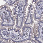 TrkB Antibody in Immunohistochemistry (Paraffin) (IHC (P))