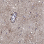 TrkB Antibody in Immunohistochemistry (Paraffin) (IHC (P))
