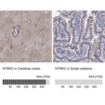 TrkB Polyclonal Antibody