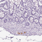 Tyrosine Hydroxylase Antibody in Immunohistochemistry (Paraffin) (IHC (P))