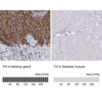 Tyrosine Hydroxylase Antibody in Immunohistochemistry (Paraffin) (IHC (P))