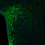 Tyrosine Hydroxylase Polyclonal Antibody