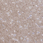 Tyrosine Hydroxylase Antibody in Immunohistochemistry (Paraffin) (IHC (P))