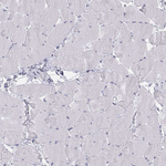 Tyrosine Hydroxylase Antibody in Immunohistochemistry (Paraffin) (IHC (P))