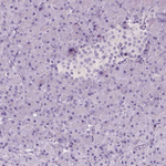 Tyrosine Hydroxylase Antibody in Immunohistochemistry (Paraffin) (IHC (P))