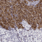 Tyrosine Hydroxylase Antibody in Immunohistochemistry (Paraffin) (IHC (P))