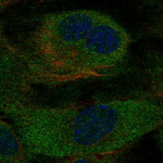 Cyclophilin B Polyclonal Antibody