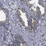 Cyclophilin B Antibody in Immunohistochemistry (Paraffin) (IHC (P))