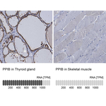 Cyclophilin B Antibody in Immunohistochemistry (Paraffin) (IHC (P))