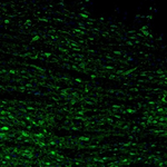 Calretinin Antibody in Immunohistochemistry (Paraffin) (IHC (P))