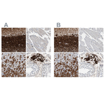 Calretinin Antibody in Immunohistochemistry (Paraffin) (IHC (P))