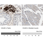 Calretinin Antibody in Immunohistochemistry (Paraffin) (IHC (P))