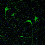 Calretinin Antibody in Immunohistochemistry (Paraffin) (IHC (P))