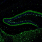 Calretinin Antibody in Immunohistochemistry (Paraffin) (IHC (P))